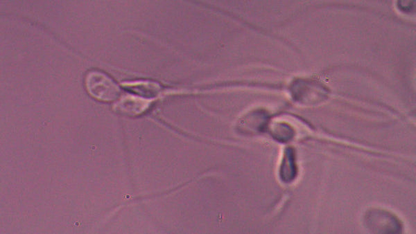 Session 117 : ZYMOT FERTILITY SYMPOSIA