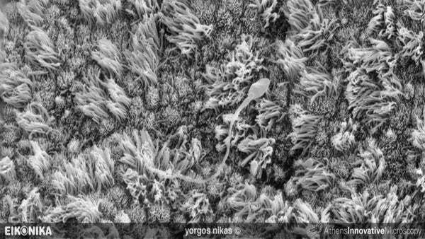 Zooming in on the most Fantastic Voyage