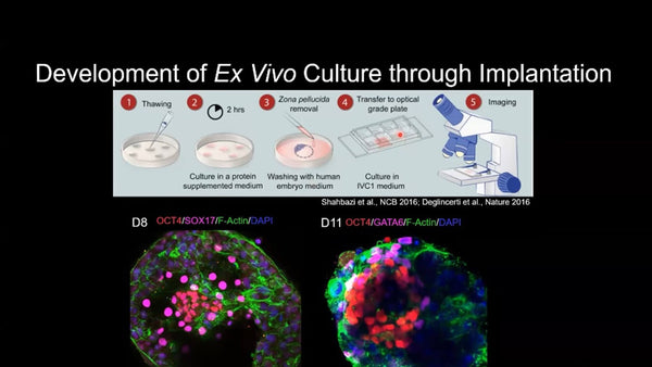 Symmetry Breaking in the Human Embryo