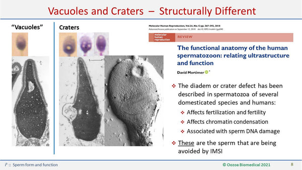 Sperm Form and Function
