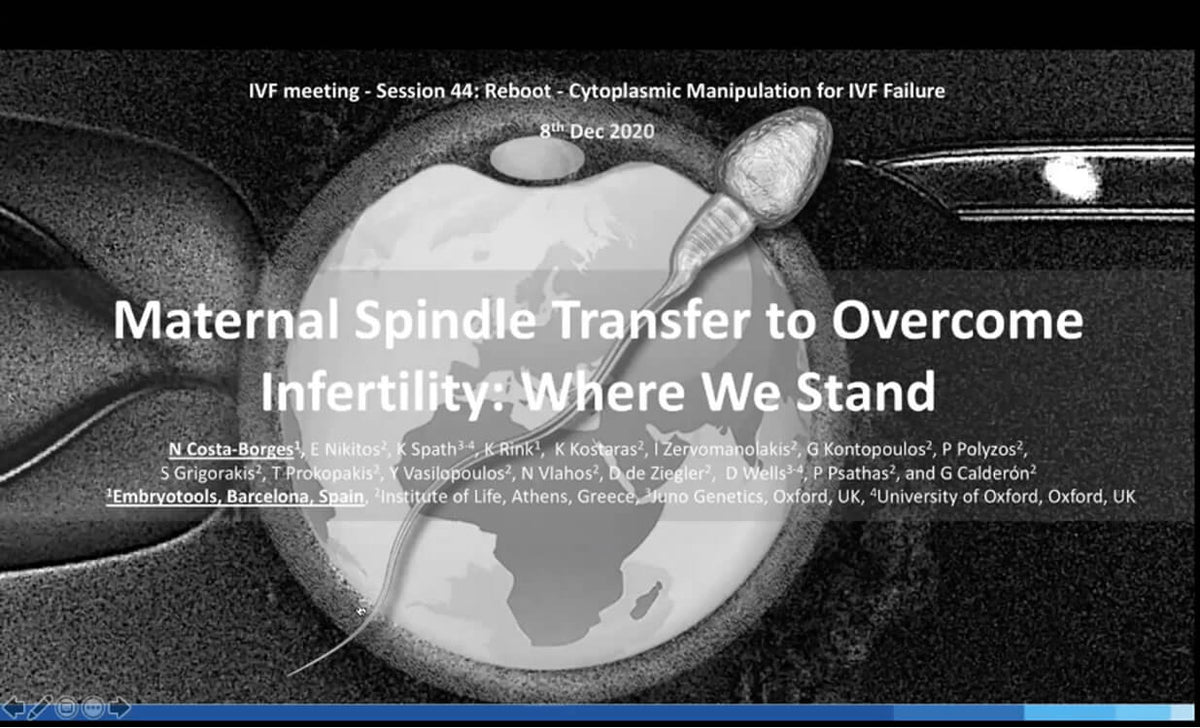 Maternal Spindle Transfer to Infertility Where We Stand