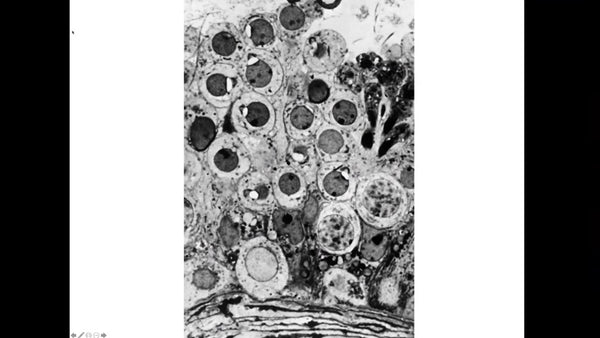 Surgically Removed Sperm, a Global View