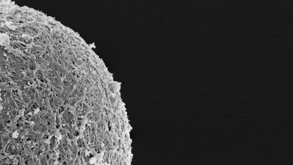 Session 151: RBM in Space