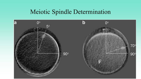 Maximizing Donor Egg Efficiency - Artificial Intelligence & Genetically Certified Oocytes