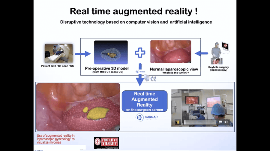 Augmented Reality in Gynecological Surgery