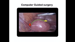 Augmented Reality in Gynecological Surgery