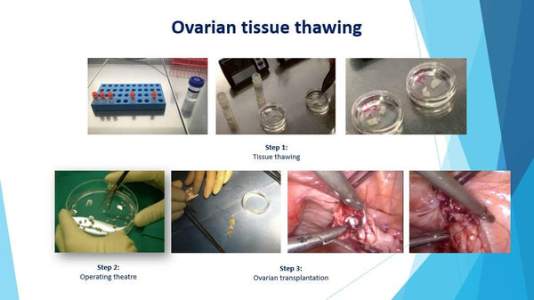 Fertility Preservation: the Embryologist’s Point of View