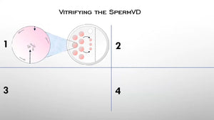 If there’s One, We can Freeze it: Managing Severe Male Factor with Single Sperm Freezing