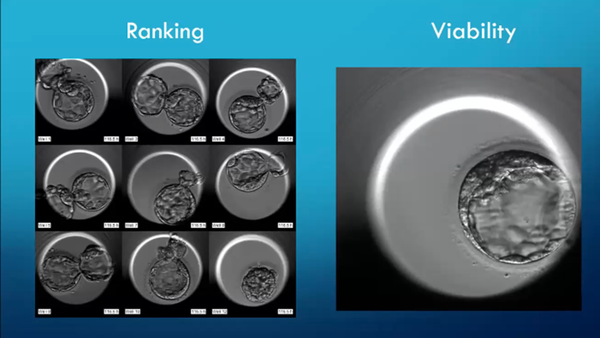 AI in Assisted Reproduction