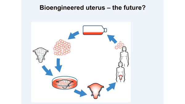 Uterus transplantation: research and clinical aspects today and in the future