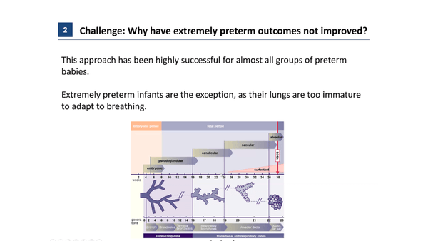 Great expectations: Development of an Artificial Placenta for Extremely Preterm Infants