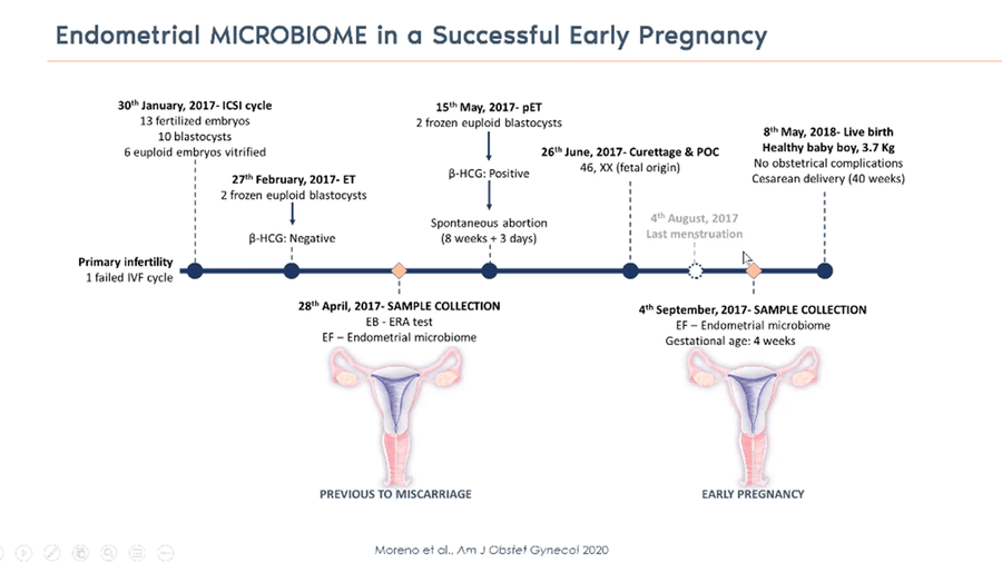 The Relevance of Uterine Microbiome in IVF Treatment
