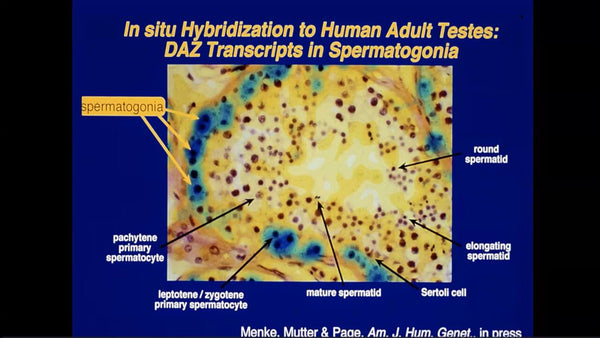 The Role of the Y Chromosome in Infertility