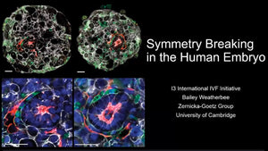 Symmetry Breaking in the Human Embryo