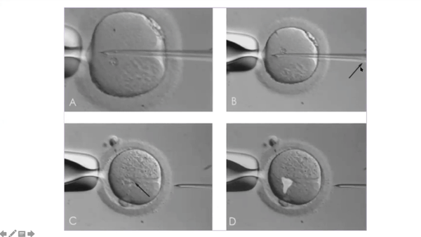 Cytoplasmic Transfer – Are the Kids Alright?