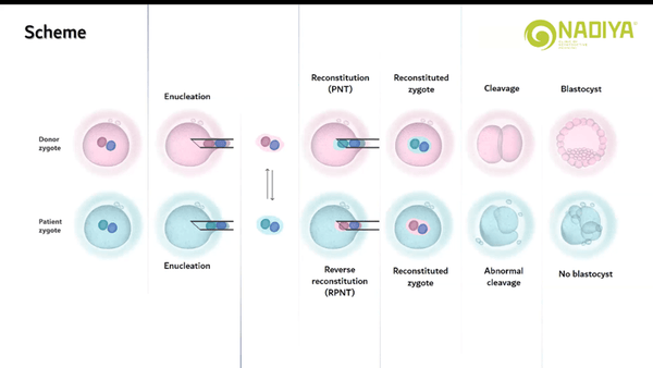 Successful Application of Pronuclear Transplantation in Patients with Repeated Failures Following Assisted Reproduction