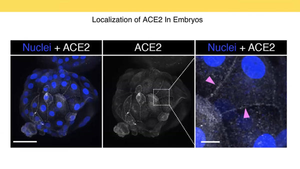 SARS-CoV-2 in the Preimplantation Embryo