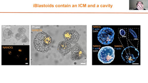 Modeling Human Blastocysts by Reprogramming Fibroblasts into iBlastoids